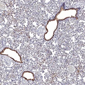 Immunohistochemistry ACE-2 Antibody (171606) [Unconjugated]