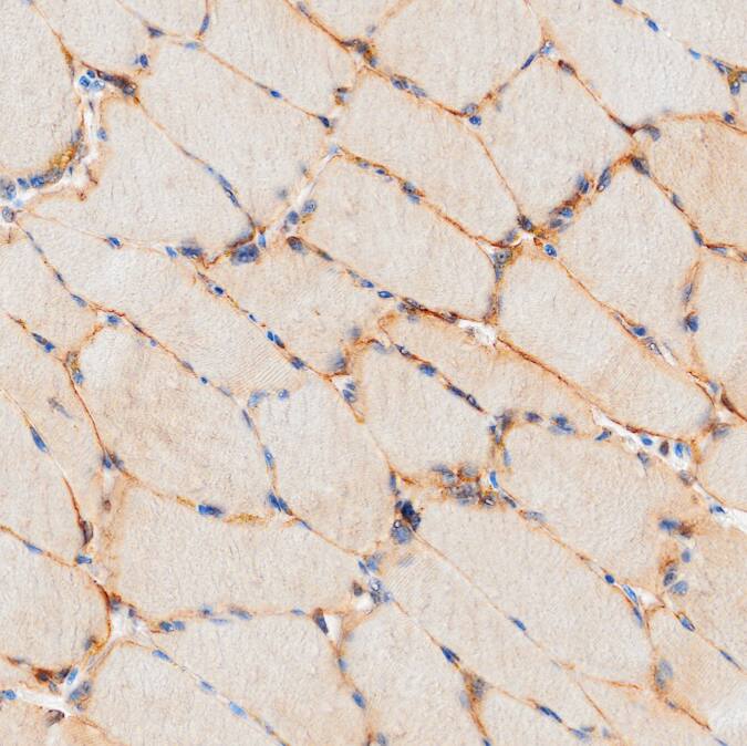 Irisin/FNDC5 was detected in immersion fixed paraffin-embedded sections of human skeletal muscle using Mouse Anti-Human Irisin/FNDC5 Monoclonal Antibody (Catalog # MAB9420) at 5 µg/ml overnight at 4 &deg;C. Before incubation with the primary antibody, tissue was subjected to heat-induced epitope retrieval using VisUCyte Antigen Retrieval Reagent-Basic (VCTS021). Tissue was stained using the HRP-conjugated Anti-Mouse IgG Secondary Antibody (HAF007) and counterstained with hematoxylin (blue). Specific staining was localized to cytoplasm. View our protocol for Chromogenic IHC Staining of Paraffin-embedded Tissue Sections.