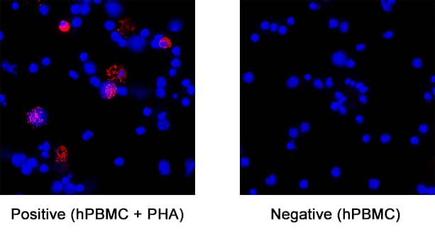 IL‑6 was detected in immersion fixed human peripheral blood mononuclear cells (PBMCs) treated with PHA (left panel; positive staining) and untreated PBMCs (right panel; negative control) using Mouse Anti-Human IL‑6 Monoclonal Antibody (Catalog # MAB95401) at 8 µg/mL for 3 hours at room temperature. Cells were stained using the NorthernLights™ 557-conjugated Anti-Mouse IgG Secondary Antibody (red; NL007) and counterstained with DAPI (blue). Specific staining was localized to cell surface. Staining was performed using our protocol for Fluorescent ICC Staining of Non-adherent Cells.