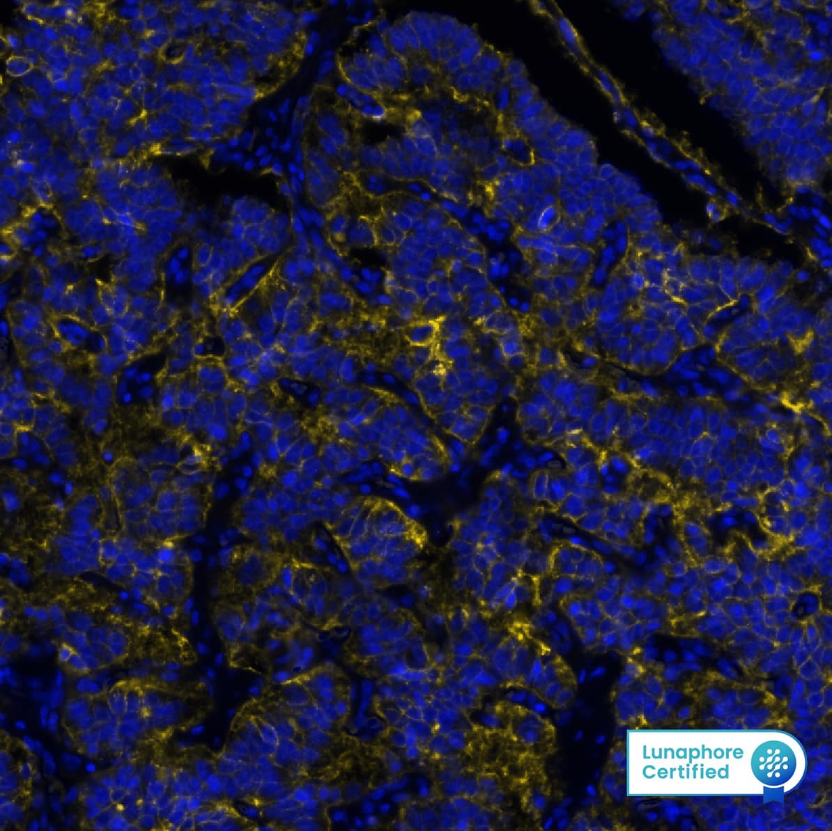 Multiplex Immunofluorescence EpCAM/TROP1 Antibody (158210) [Unconjugated]