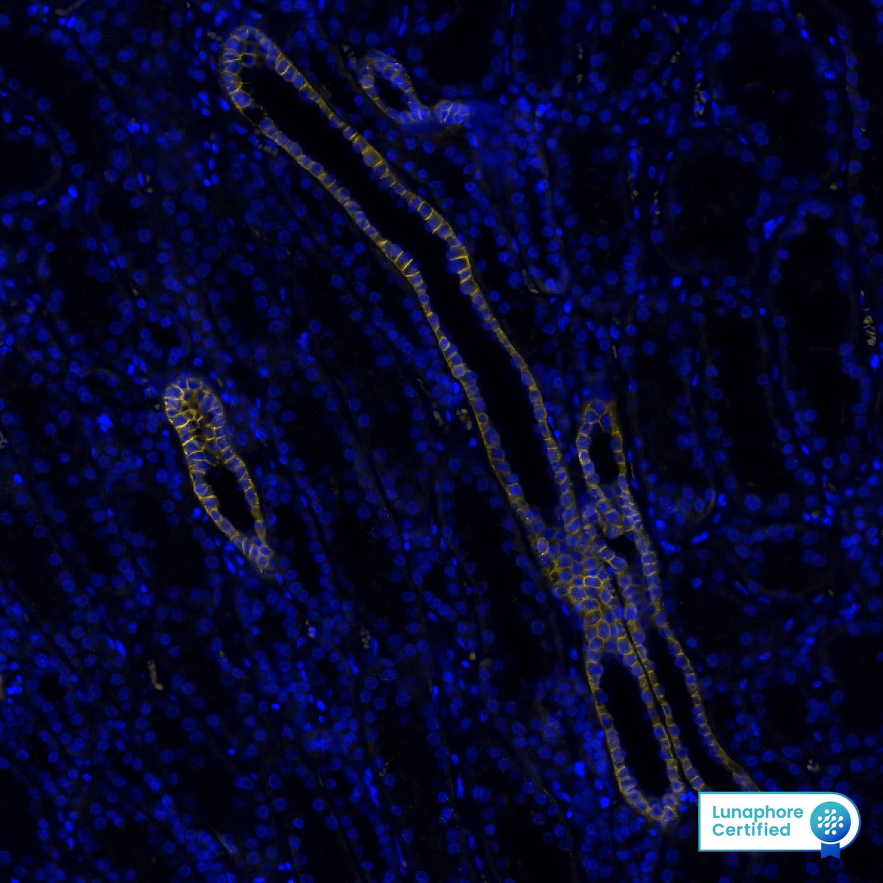 Multiplex Immunofluorescence EpCAM/TROP1 Antibody (158210) [Unconjugated]