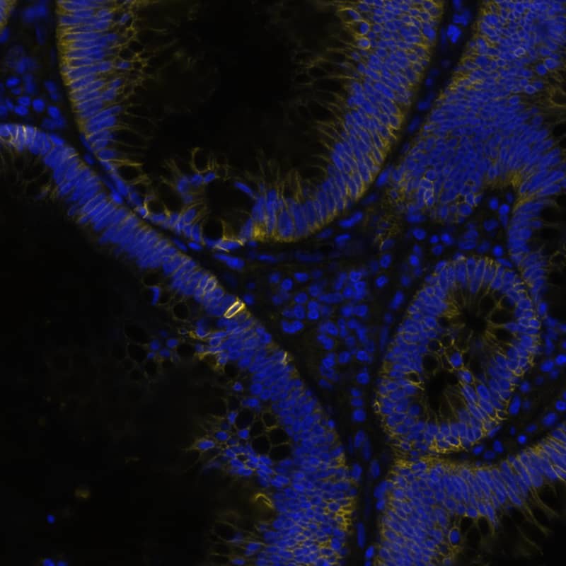 EMMPRIN/CD147 was detected in immersion fixed paraffin-embedded sections of human colon using Mouse Anti-Human EMMPRIN/CD147 Monoclonal Antibody (Catalog # MAB9721) at 1 µg/mL at 37 ° Celsius for 4 minutes. Before incubation with the primary antibody, tissue underwent an all-in-one dewaxing and antigen retrieval preprocessing using PreTreatment Module (PT Module) and Dewax and HIER Buffer H (pH 9; Epredia Catalog # TA-999-DHBH). Tissue was stained using the Alexa Fluor™ 647 Goat anti-Mouse IgG Secondary Antibody at 1:200 at 37 ° Celsius for 2 minutes. (Yellow; Lunaphore Catalog # DR647MS) and counterstained with DAPI (blue; Lunaphore Catalog # DR100). Specific staining was localized to the membrane. Protocol available in COMET™ Panel Builder.