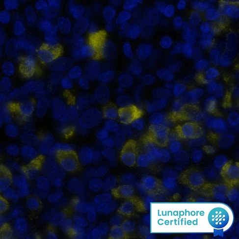 IgD was detected in immersion fixed paraffin-embedded sections of human Tonsil using Mouse Anti-Human IgD, Monoclonal Antibody (Catalog # MAB9857) at 0.5ug/mL at 37 ° Celsius for 2 minutes. Before incubation with the primary antibody, tissue underwent an all-in-one dewaxing and antigen retrieval preprocessing using PreTreatment Module (PT Module) and Dewax and HIER Buffer H (pH 9; Epredia Catalog # TA-999-DHBH). Tissue was stained using the Alexa Fluor™ 555 Goat anti-Mouse IgG Secondary Antibody at 1:100 at 37 ° Celsius for 2 minutes. (Yellow; Lunaphore Catalog # DR555MS) and counterstained with DAPI (blue; Lunaphore Catalog # DR100). Specific staining was localized to the cytoplasm. Protocol available in COMET™ Panel Builder.​​