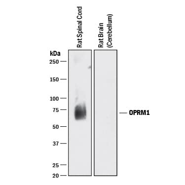 Western blot shows lysates of rat spinal cord tissue and rat brain (cerebellum) tissue (negative control). PVDF membrane was probed with 0.5 µg/mL of Rabbit Anti-Rat µ Opioid R/OPRM1 Monoclonal Antibody (Catalog # MAB86291) followed by HRP-conjugated Anti-Rabbit IgG Secondary Antibody (Catalog # HAF008). A specific band was detected for µ Opioid R/OPRM1 at approximately 70 kDa (as indicated). This experiment was conducted under reducing conditions and using Immunoblot Buffer Group 1.