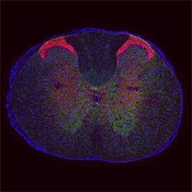 Immunohistochemistry mu Opioid R/OPRM1 Antibody (1126B) [Unconjugated]