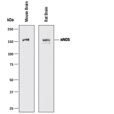 Western Blot nNOS Antibody [Unconjugated]
