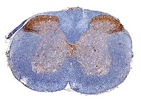 nNOS was detected in perfusion fixed frozen sections of mouse spinal cord using Mouse Anti-Human/Mouse/Rat nNOS Monoclonal Antibody (Catalog # MAB24162) at 5 µg/mL for 1 hour at room temperature followed by incubation with the Anti-Mouse IgG VisUCyte™ HRP Polymer Antibody (Catalog # VC001). Tissue was stained using DAB (brown) and counterstained with hematoxylin (blue). Specific staining was localized to dorsal horn. View our protocol for IHC Staining with VisUCyte HRP Polymer Detection Reagents.