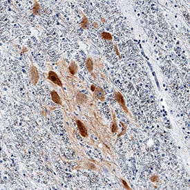 nNOS was detected in immersion fixed paraffin-embedded sections of human brain (substantia nigra) using Mouse Anti-Human/Mouse/Rat nNOS Monoclonal Antibody (Catalog # MAB24162) at 5 µg/mL for 1 hour at room temperature followed by incubation with the Anti-Mouse IgG VisUCyte™ HRP Polymer Antibody (Catalog # VC001). Tissue was stained using DAB (brown) and counterstained with hematoxylin (blue). Specific staining was localized to neuronal cell bodies and processes. View our protocol for IHC Staining with VisUCyte HRP Polymer Detection Reagents.