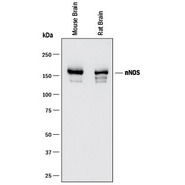 Western blot shows lysates of mouse brain tissue and rat brain tissue. PVDF membrane was probed with 0.5 µg/mL of Mouse Anti-Human/Mouse/Rat nNOS Monoclonal Antibody (Catalog # MAB24162) followed by HRP-conjugated Anti-Mouse IgG Secondary Antibody (Catalog # HAF018). A specific band was detected for nNOS at approximately 160 kDa (as indicated). This experiment was conducted under reducing conditions and using Immunoblot Buffer Group 1.
