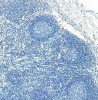 Control: Goat Polyclonal ADAM8 Antibody [NB100-1017] - Negative Control showing staining of paraffin embedded Human Lymph Node, with no primary antibody.