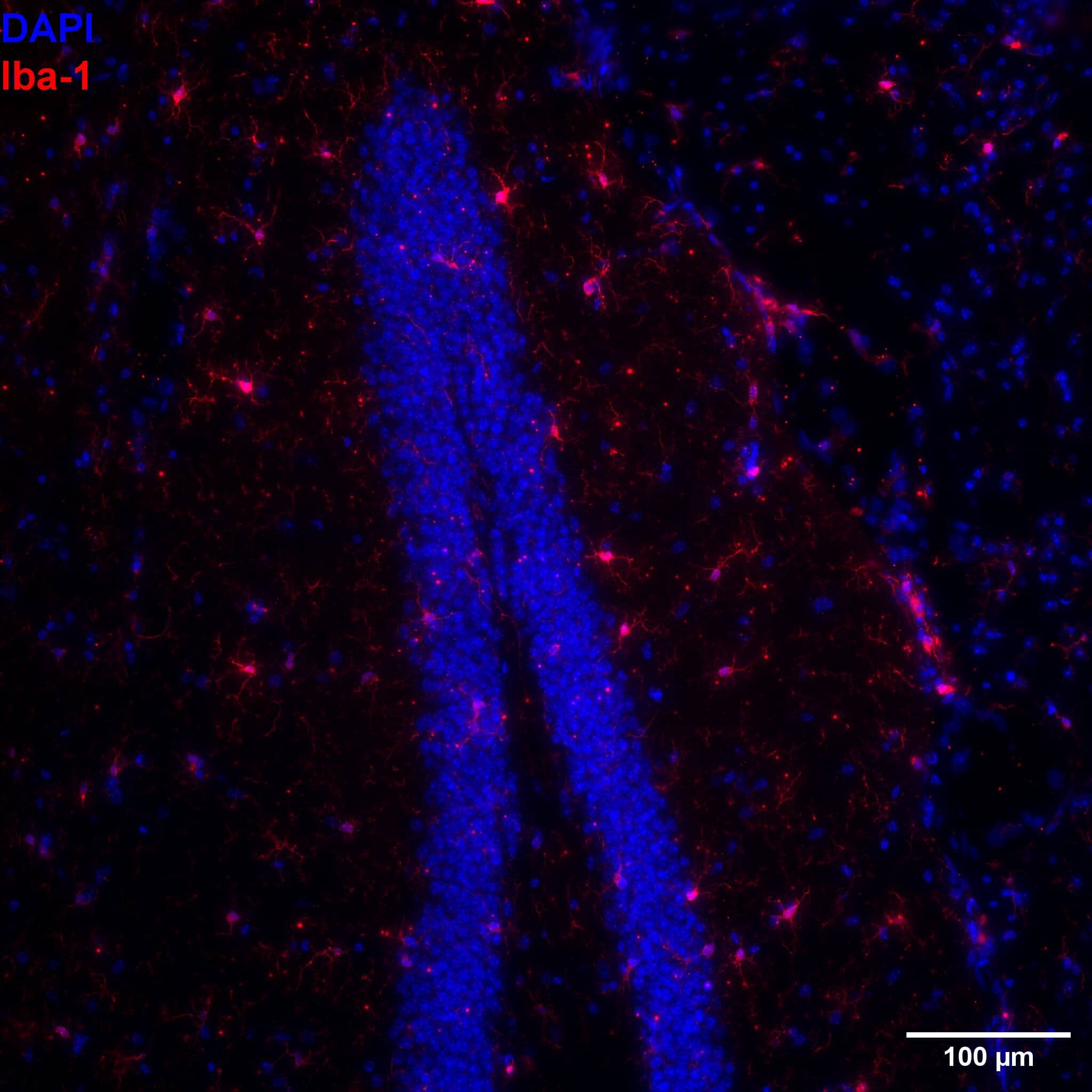 Immunohistochemistry-Frozen: Goat Polyclonal AIF-1/Iba1 Antibody [NB100-1028] - AD Mouse Model. FxFr:10 µm thickness 1:200. Secondary antibody AF647. Image from a verified customer review.