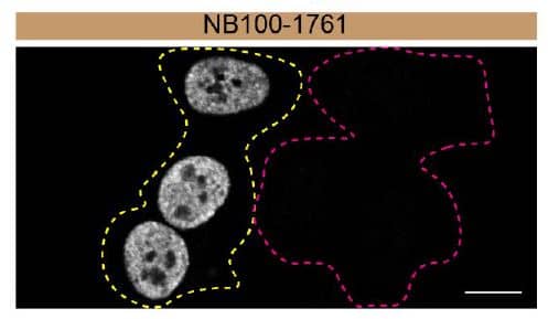 HAP1 WT and Matrin 3 KO cells were labelled with a green or a far-red fluorescent dye, respectively. Cells were stained with Rab1A antibody and with the corresponding Alexa-fluor 555 coupled secondary antibody including DAPI. Acquisition of the blue (nucleus-DAPI), green (identification of WT cells), red (antibody staining) and far-red (identification of KO cells) channels was performed. Representative images of the blue and red (grayscale) channels are shown. WT and KO cells are outlined with green and magenta dashed line, respectively. Antibody dilution used: 1/200. Image, protocol and testing courtesy of YCharOS Inc. (ycharos.com).