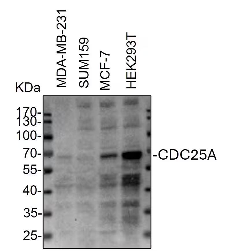 Western Blot: Rabbit Polyclonal CDC25A Antibody [NB100-213] - Whole cell lysates from MDA-MB-231, SUM159, MCF-7 and HEK293T cells were loaded with 50 ug/lane. 10% SDS-PAGE. CDC25A Antibody (NB100-213) was used for primary antibody: 1:1000, 4℃, overnight. Image from a verified customer review.