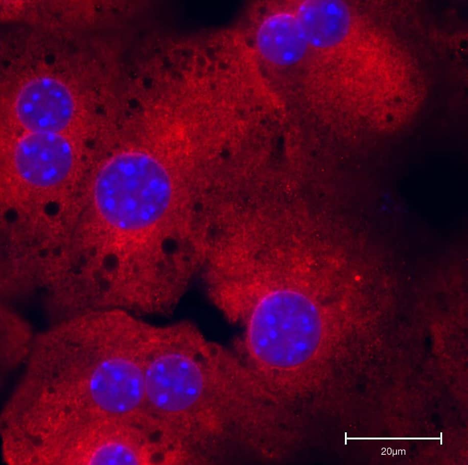 Immunocytochemistry/Immunofluorescence: Rabbit Polyclonal RelA/NFkB p65 Antibody [NB100-2176] - Mice hepatocytes stained for RelA/NFkB p65. Image from a verified customer review.