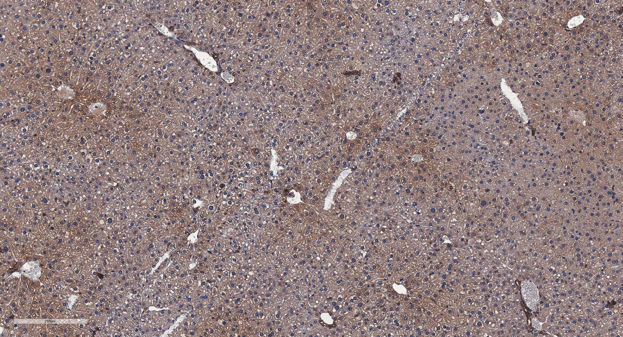 Immunohistochemistry-Paraffin: Rabbit Polyclonal RelA/NFkB p65 Antibody [NB100-2176] - RelA/NFkB p65 IHC (brown) in the mice liver tissue; bars, 200 μm. Image from a verified customer review.