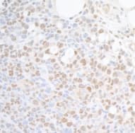 Section of mouse plasmacytoma. Antibody:Affinity purified rabbit anti- SUPT6H used at a dilution of 1:200 (1µg/ml). Detection: DAB