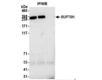 Whole cell lysate (1.0 mgper IP reaction; 20% of IP loaded) from HEK293T cellsprepared using NETN lysis buffer. Antibodies: Affinitypurified rabbit anti-SUPT6H antibody) used for IP at 6 µg per reaction. SUPT6Hwas also immunoprecipitated by a previous lot of thisantibody.  For blottingimmunoprecipitated SUPT6H, was used at 0.04µg/ml. Detection: Chemiluminescence with an exposuretime of 75 seconds.