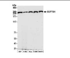  Whole cell lysate (50 µg) from HEK293T, K-562,HeLa, TCMK-1, and NIH 3T3 cells prepared using NETNlysis buffer. Antibody: Affinity purified rabbit anti-SUPT6Hantibody used for WB at0.04 µg/ml. Detection: Chemiluminescence with anexposure time of 3 minutes.