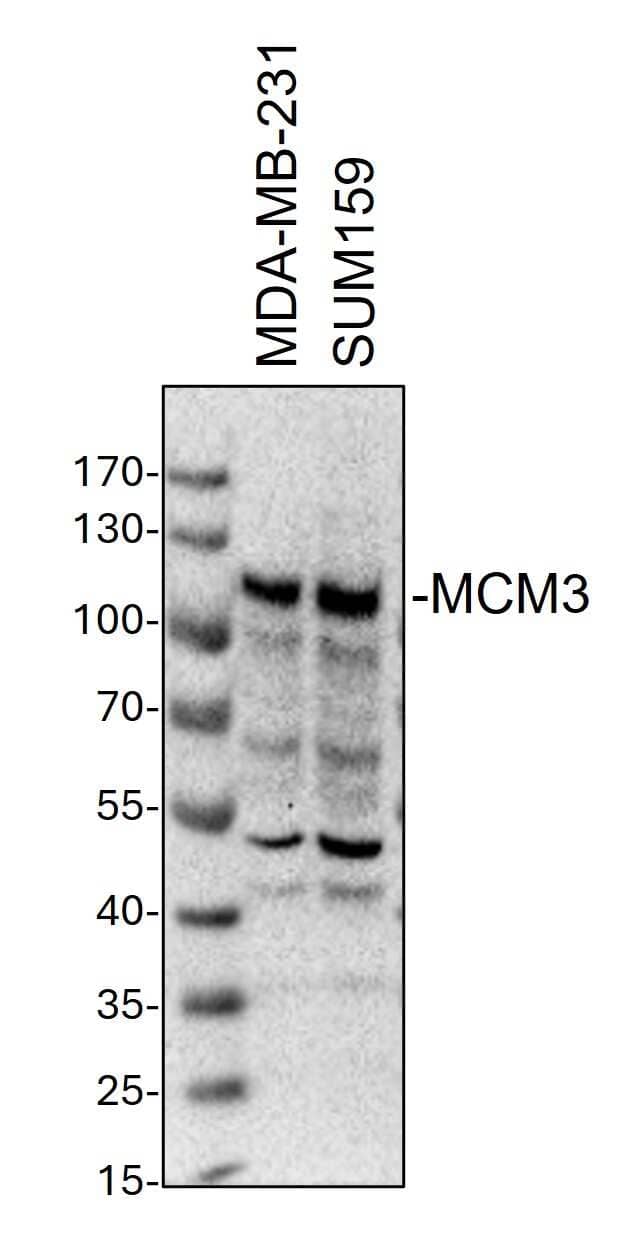 Western Blot: Rabbit Polyclonal MCM3 Antibody [NB100-289] - Whole cell lysates from MDA-MB-231 and SUM159 cells were loaded with 50 ug/lane. 10% SDS-PAGE. MCM3 Antibody (NB100-289) was used for primary antibody: 1:1000, 4℃, overnight. Image from a verified customer review.