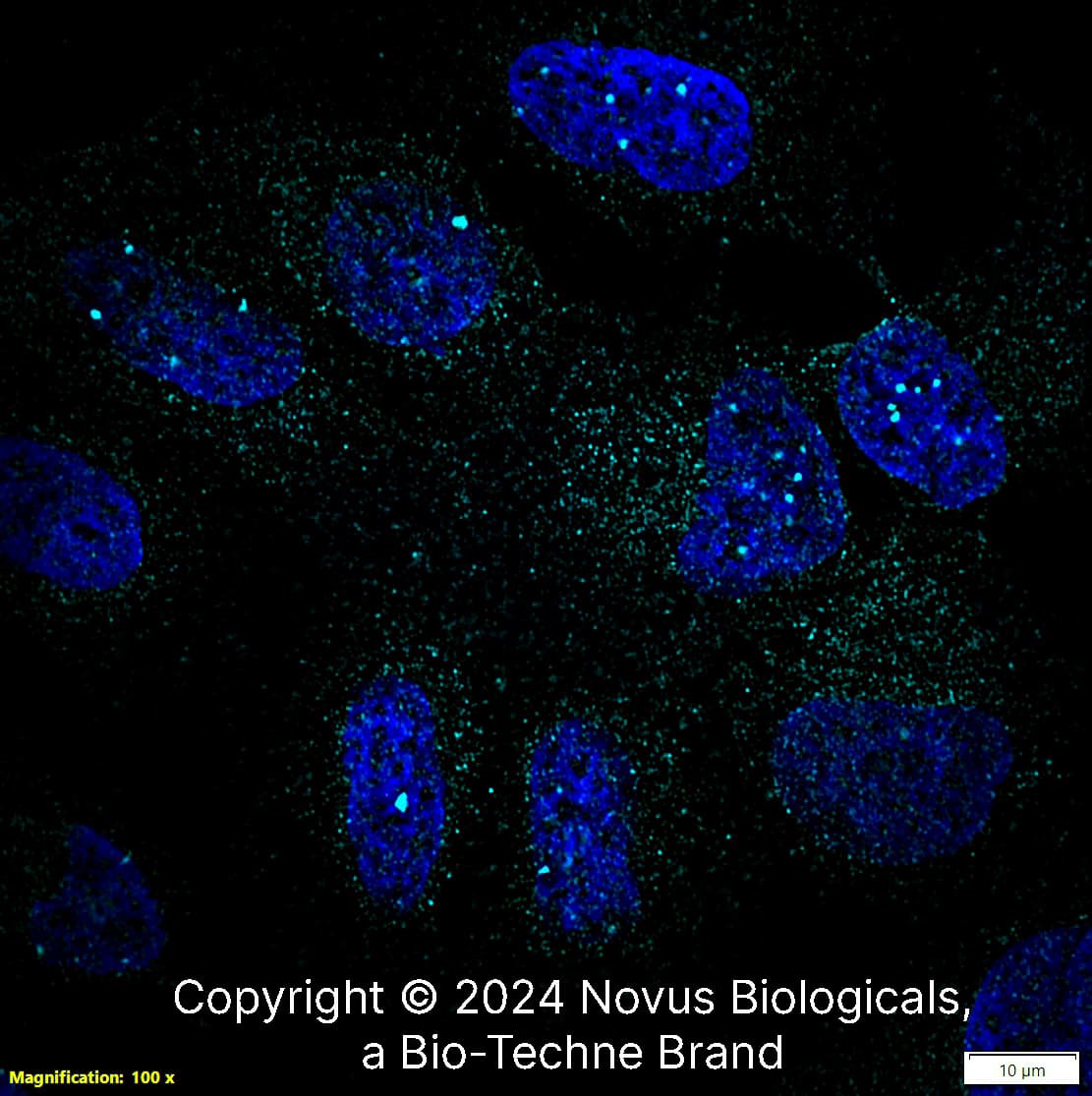 53BP1 was detected in immersion fixed U-2 OS human osteosarcoma cell line using Rabbit anti-53BP1 Antigen Affinity Purified Polyclonal Antibody conjugated to Alexa Fluor ® 647 (Catalog # NB100-304AF647) (light blue) at 5 µg/mL overnight at 4C. Cells were counterstained with DAPI (blue). Cells were imaged using a 100X objective and digitally deconvolved. 