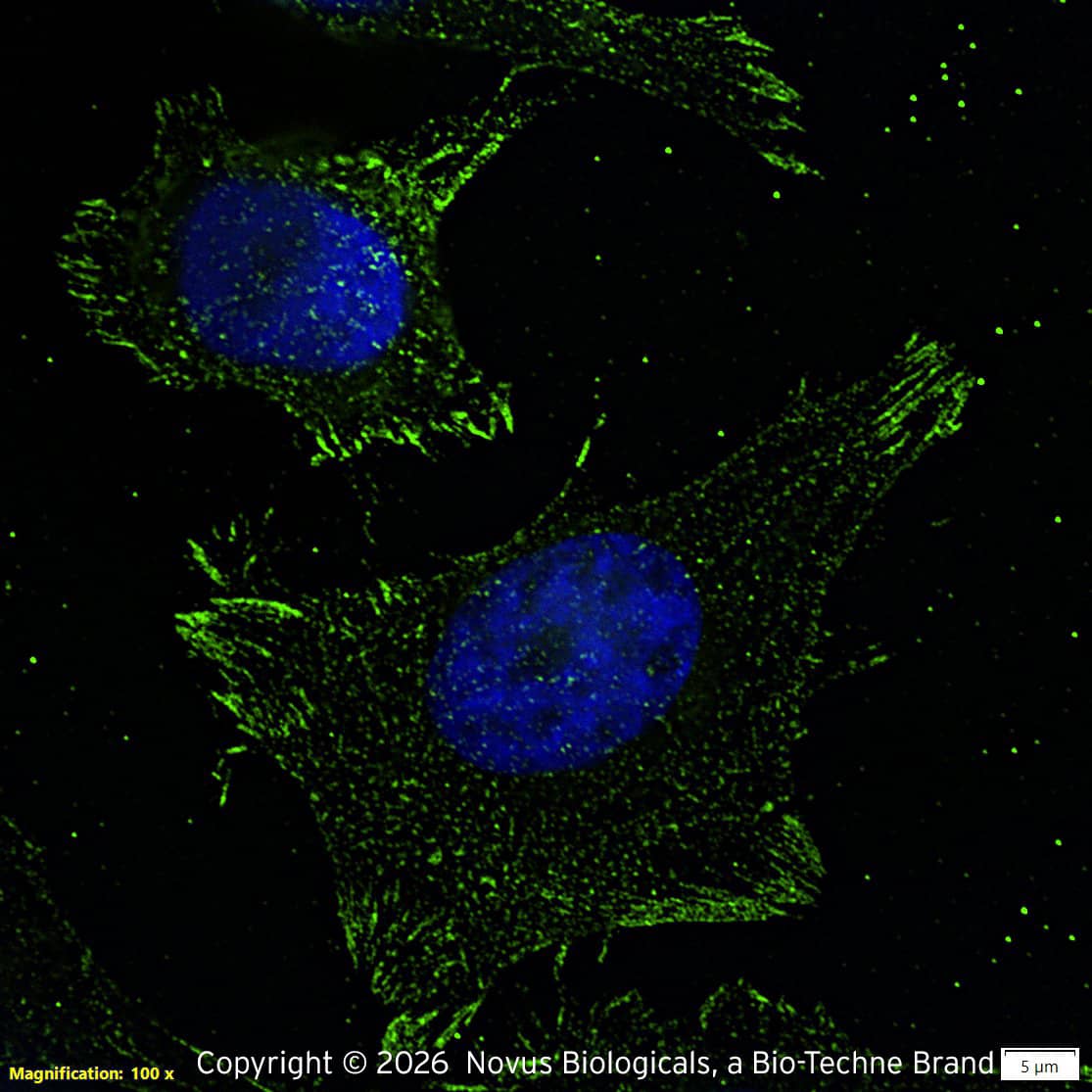 N/A 14-3-3 gamma [ac Val2] Antibody (KC21) - BSA Free