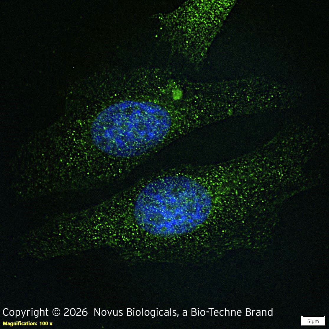 PINK1 was detected in immersion fixed HeLa human cervix adenocarcinoma cell line using Rabbit anti-PINK1 Antigen Affinity Purified Polyclonal Antibody (Catalog # NB100-493) at 1.0 µg/mL overnight at 4C.  Cells were stained using DyLight 488-conjugated Anti-Rabbit IgG (H+L) Cross-Absorbed Secondary Antibody (green), and counterstained with DAPI (blue). Cells were imaged using a 100X objective and digitally deconvolved.