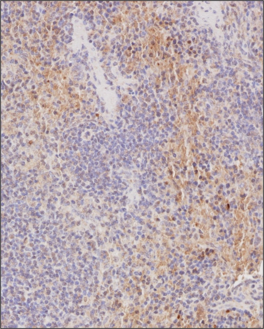 Analysis of a FFPE tissue section of mouse spleen using 1:200 dilution of CCR1 (NB100-56334) antibody. The staining was developed using HRP labeled anti-rabbit secondary antibody and DAB reagent, and nuclei of cells were counter-stained with hematoxylin.