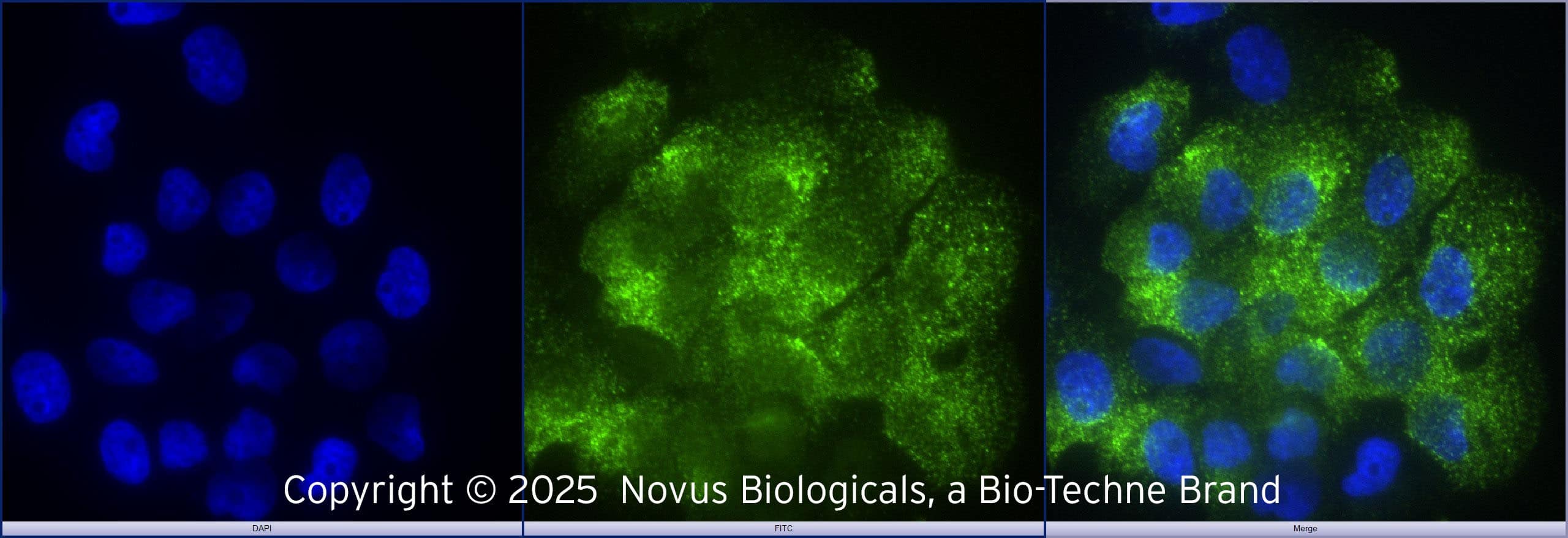 TLR2 was detected in immersion fixed A431 human skin carcinoma cell line using Rabbit anti-TLR2 Protein G purified Polyclonal Antibody (Catalog # NB100-56720) at 1.0 µg/mL overnight at 4C.  Cells were stained using DyLight 488-conjugated Anti-Rabbit IgG (H+L) Cross-Absorbed Secondary Antibody (green), and counterstained with DAPI (blue).  Cells were imaged using a 40X objective.