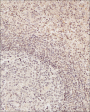 Analysis of a FFPE tissue section of human spleen using 1:200 dilution of TLR2 antibody. The staining was developed using HRP labeled anti-rabbit secondary antibody and DAB reagent, and nuclei of cells were counter-stained with hematoxylin.