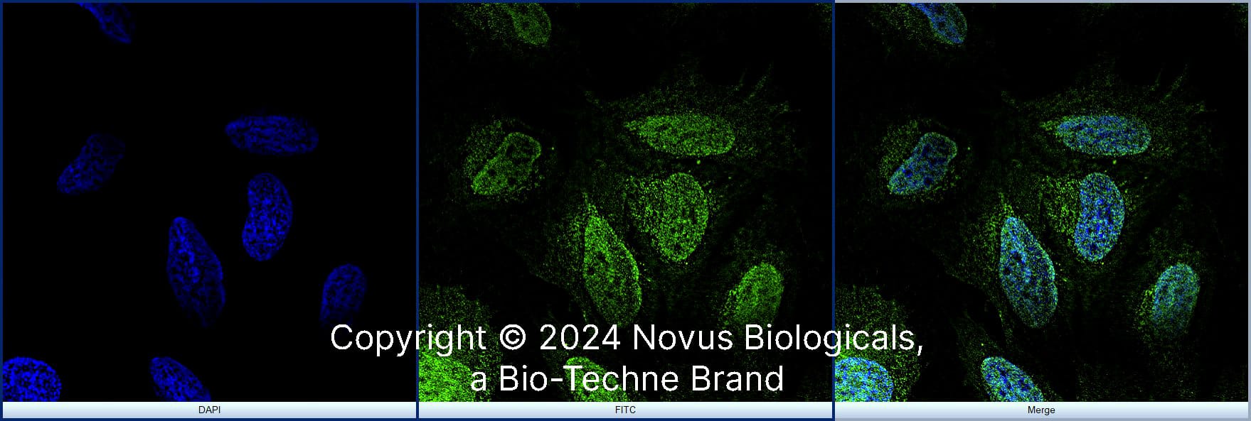 NGFI-B alpha/Nur77/NR4A1 was detected in immersion fixed U-2 OS human osteosarcoma cell line using Rabbit anti-NGFI-B alpha/Nur77/NR4A1 Antigen Affinity Purified Polyclonal Antibody conjugated to Alexa Fluor® 488 (Catalog # NB100-56745AF488) (green) at 10 µg/mL overnight at 4C. Cells were counterstained with DAPI (blue). Cells were imaged using a 100X objective and digitally deconvolved. 