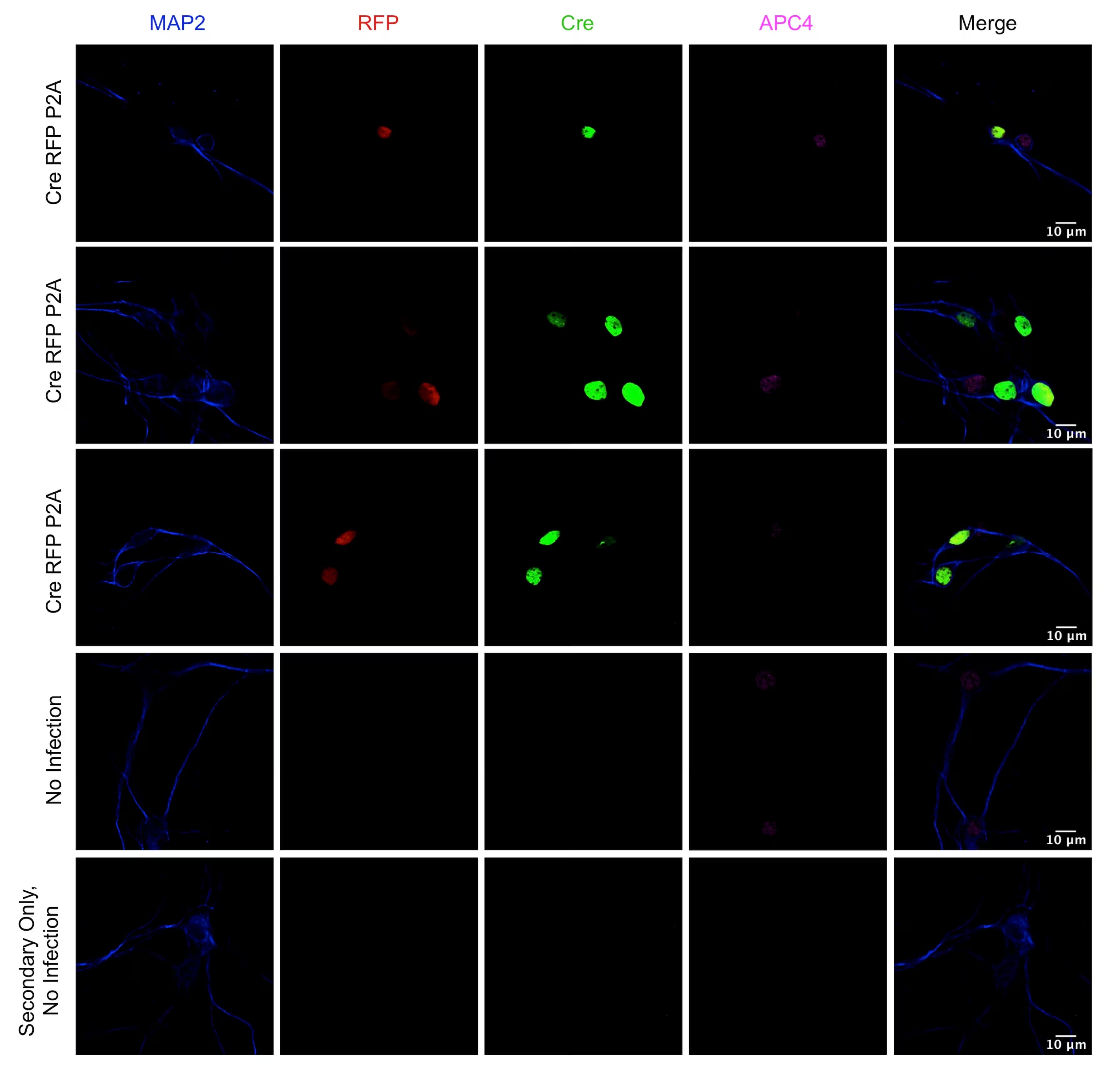 Immunocytochemistry/ Immunofluorescence Apc4 Antibody