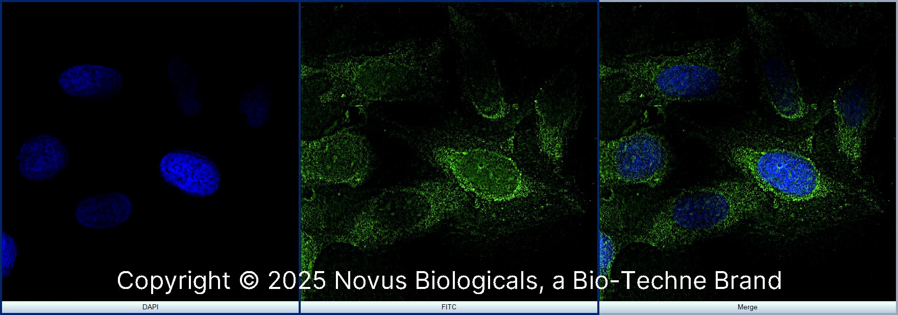 rRNA (Yb10) was detected in immersion fixed U-2 OS human osteosarcoma cell line using Mouse anti-rRNA (Yb10) Protein G Purified Monoclonal Antibody conjugated to Alexa Fluor® 488 (Catalog # NB100-662AF488) (green) at 10 µg/mL overnight at 4C. Cells were counterstained with DAPI (blue). Cells were imaged using a 100X objective and digitally deconvolved.  
