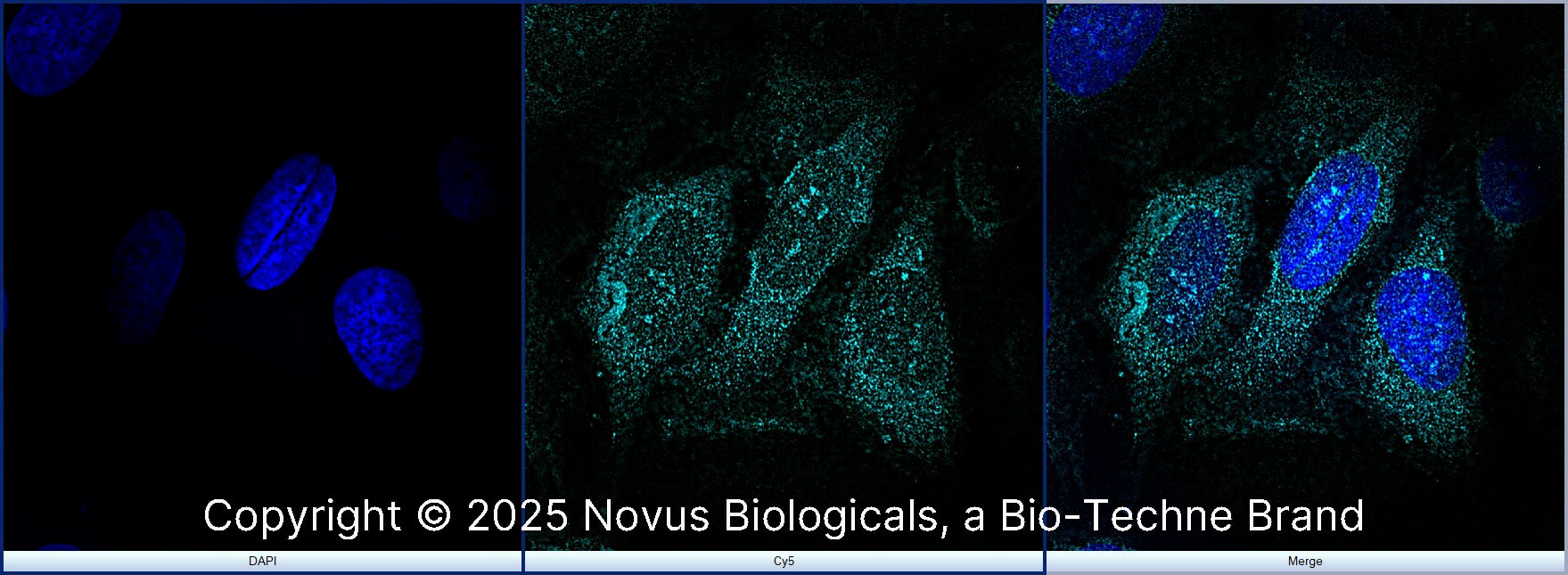 rRNA (Yb10) was detected in immersion fixed U-2 OS human osteosarcoma cell line using Mouse anti-rRNA (Yb10) Protein G Purified Monoclonal Antibody conjugated to Alexa Fluor® 647 (Catalog # NB100-662AF647) (light blue) at 10 µg/mL overnight at 4C. Cells were counterstained with DAPI (blue). Cells were imaged using a 100X objective and digitally deconvolved.  