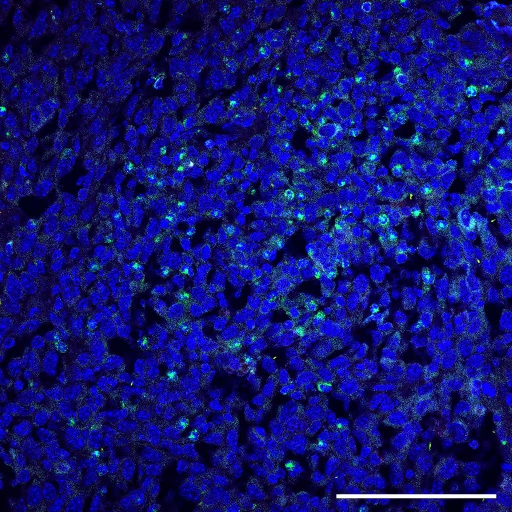 Immunohistochemistry: Mouse Monoclonal Salmonella typhimurium Antibody (1E6cc) [NB110-16952] - Staining of bacteria in GL261 implanted mouse glioma tissue using Salmonella typhimurium Antibody (1E6cc) [Alexa Fluor® 488] (Catalog # NB110-16952AF488). Image from a verified customer review.