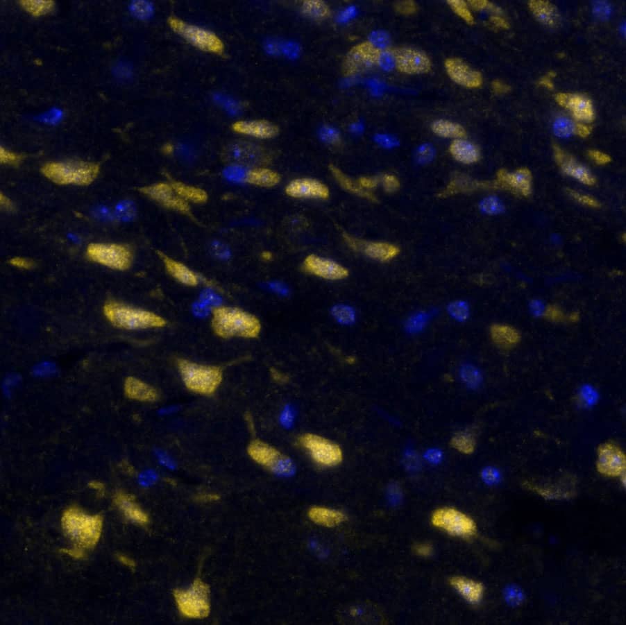 SOX2 Antibody was detected in immersion fixed paraffin-embedded sections of mouse Brain Cortex using Rabbit Anti-Mouse SOX2, Monoclonal Antibody (Catalog # NB110-37235) at 1:125 dilution at 37 ° Celsius for 4 minutes. Before incubation with the primary antibody, tissue underwent an all-in-one dewaxing and antigen retrieval preprocessing using PreTreatment Module (PT Module) and Dewax and HIER Buffer H (pH 9; Epredia Catalog # TA-999-DHBH). Tissue was stained using the Alexa Fluor™ Plus 647 Goat anti-Rabbit IgG Secondary Antibody at 1:200 at 37 ° Celsius for 2 minutes. (Yellow; Lunaphore Catalog # DR647RB) and counterstained with DAPI (blue; Lunaphore Catalog # DR100). Specific staining was localized to the nucleus and cytoplasm. Protocol available in COMET™ Panel Builder.