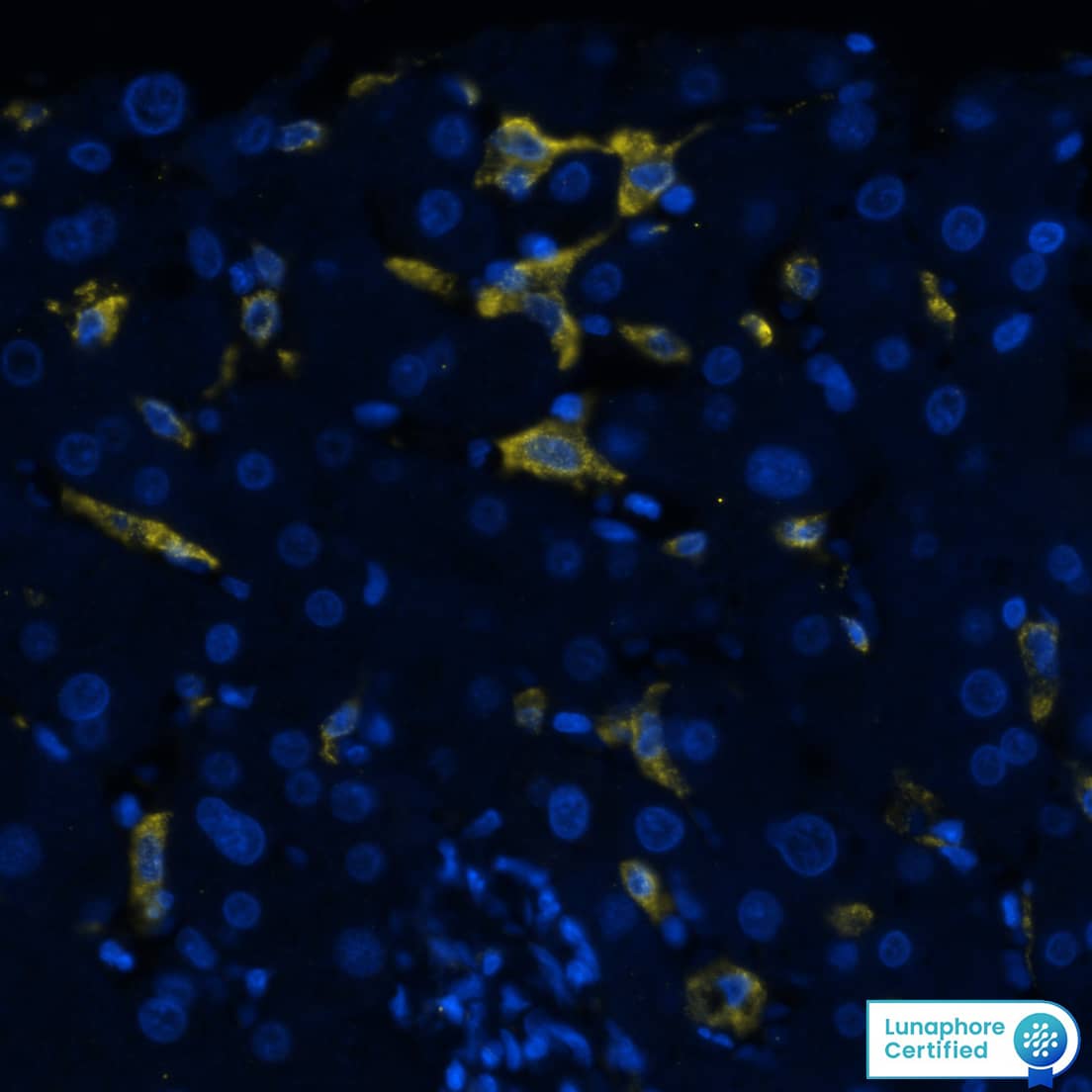 CD163 was detected in immersion fixed paraffin-embedded sections of human liver using Mouse Anti-Human CD163 Monoclonal Antibody (Novus Catalog # NB110-40686) at 1:50 at 37 °Celsius for 8 minutes. Before incubation with the primary antibody, tissue underwent an all-in-one dewaxing and antigen retrieval preprocessing using PreTreatment Module (PT Module) and Dewax and HIER Buffer H (pH 9; Epredia Catalog # TA-999-DHBH). Tissue was stained using the Alexa Fluor™ 647 Goat anti-Mouse IgG Secondary Antibody at 1:200 at 37 ° Celsius for 2 minutes. (Yellow; Lunaphore Catalog # DR647MS) and counterstained with DAPI (blue; Lunaphore Catalog # DR100). Specific staining was localized to the membrane and cytoplasm. Protocol available in COMET™ Panel Builder.