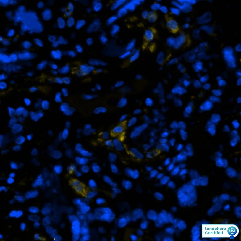 CD163 was detected in immersion fixed paraffin-embedded sections of human placenta using Mouse Anti-Human CD163 Monoclonal Antibody (Novus Catalog # NB110-40686) at 1:50 at 37 °Celsius for 8 minutes. Before incubation with the primary antibody, tissue underwent an all-in-one dewaxing and antigen retrieval preprocessing using PreTreatment Module (PT Module) and Dewax and HIER Buffer H (pH 9; Epredia Catalog # TA-999-DHBH). Tissue was stained using the Alexa Fluor™ 647 Goat anti-Mouse IgG Secondary Antibody at 1:200 at 37 ° Celsius for 2 minutes. (Yellow; Lunaphore Catalog # DR647MS) and counterstained with DAPI (blue; Lunaphore Catalog # DR100). Specific staining was localized to the membrane and cytoplasm. Protocol available in COMET™ Panel Builder.