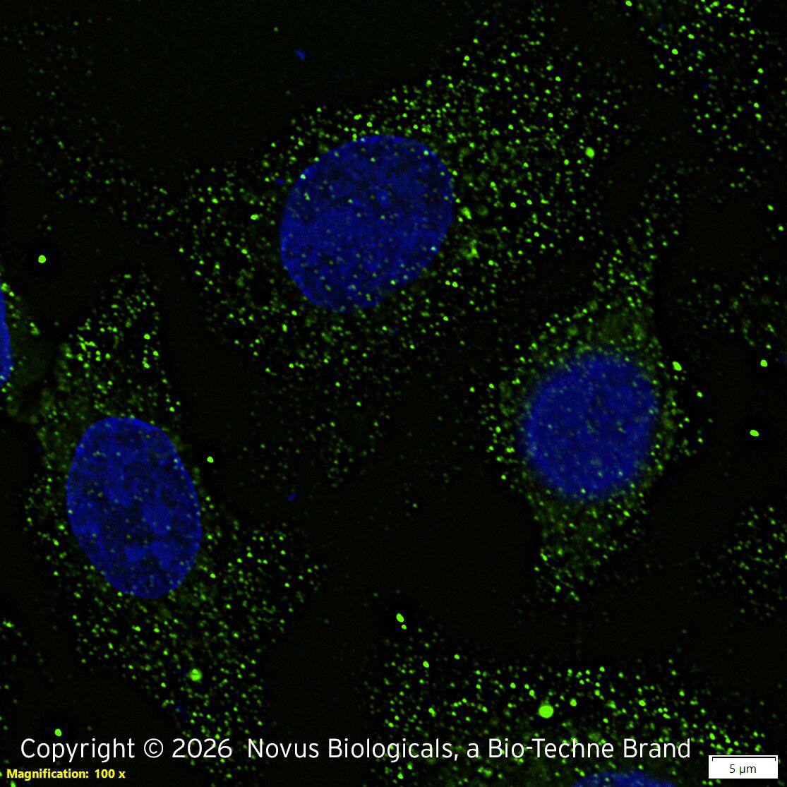 Perilipin was detected in immersion fixed HepG2 human hepatocellular carcinoma cell line using Rabbit anti-Perilipin Antigen Affinity Purified Polyclonal Antibody (Catalog # NB110-40760) at 1.0 µg/mL overnight at 4C.  Cells were stained using DyLight 488-conjugated Anti-Rabbit IgG (H+L) Cross-Absorbed Secondary Antibody (green), and counterstained with DAPI (blue). Cells were imaged using a 100X objective and digitally deconvolved.