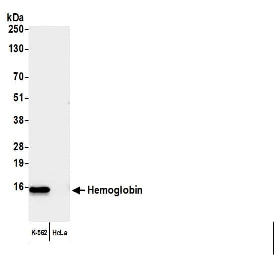 Western Blot Hemoglobin Antibody - BSA Free