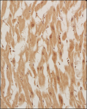 Analysis of a FFPE tissue section of human heart using 1:200 dilution of OXPAT antibody. The staining was developed using HRP labeled anti-rabbit secondary antibody and DAB reagent, and nuclei of cells were counter-stained with hematoxylin.