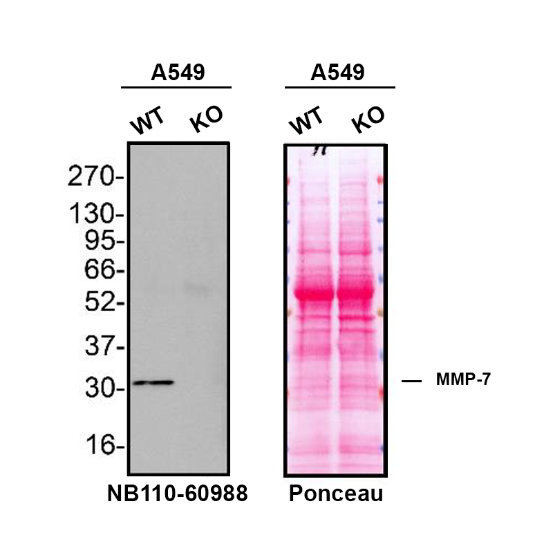 Western blot shows lysates of A549 human lung carcinoma parental cell line and MMP-7 knockout A549 cell line (KO). Nitrocellulose membrane was probed with MMP-7 Antibody (MM0022-4C21) - Azide and BSA Free (Catalog # NB110-60988) followed by HRP-conjugated secondary antibody. A specific band was detected for MMP-7 at approximately 29.7 kDa (as indicated) in the parental A549 cell line, but is not detectable in knockout A549 cell line. Primary antibody dilution used: 1/1000. The Ponceau stained transfer of the blot is shown. This experiment was conducted under reducing conditions. Image, protocol, and testing courtesy of YCharOS Inc. See ycharos.com for additional details.