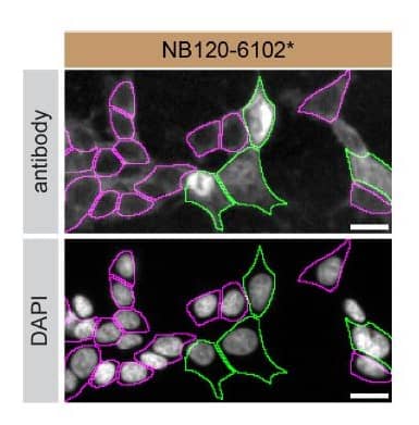 HAP1 WT and hnRNP A2B1 KO cells were labelled with a green or a far-red fluorescent dye, respectively. Cells were stained with hnRNP A2B1 antibody and with the corresponding Alexa-fluor 555 coupled secondary antibody including DAPI. Acquisition of the blue (nucleus-DAPI), green (identification of WT cells), red (antibody staining) and far-red (identification of KO cells) channels was performed. Representative images of the blue and red (grayscale) channels are shown. WT and KO cells are outlined with green and magenta dashed line, respectively. Antibody dilution used: 1/1000. Image, protocol and testing courtesy of YCharOS Inc. (ycharos.com).