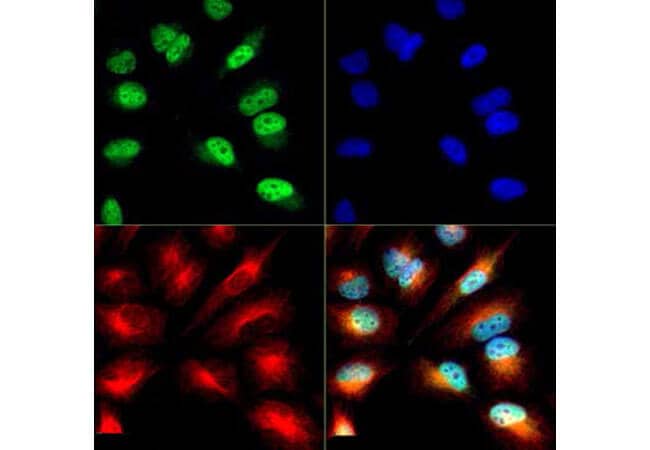 Histone H3 K9-Ac/pS10 antibody was tested in HeLa cells with DyLight 488 (green). Nuclei and alpha-tubulin were counterstained with DAPI (blue) and DyLight 550 (red).