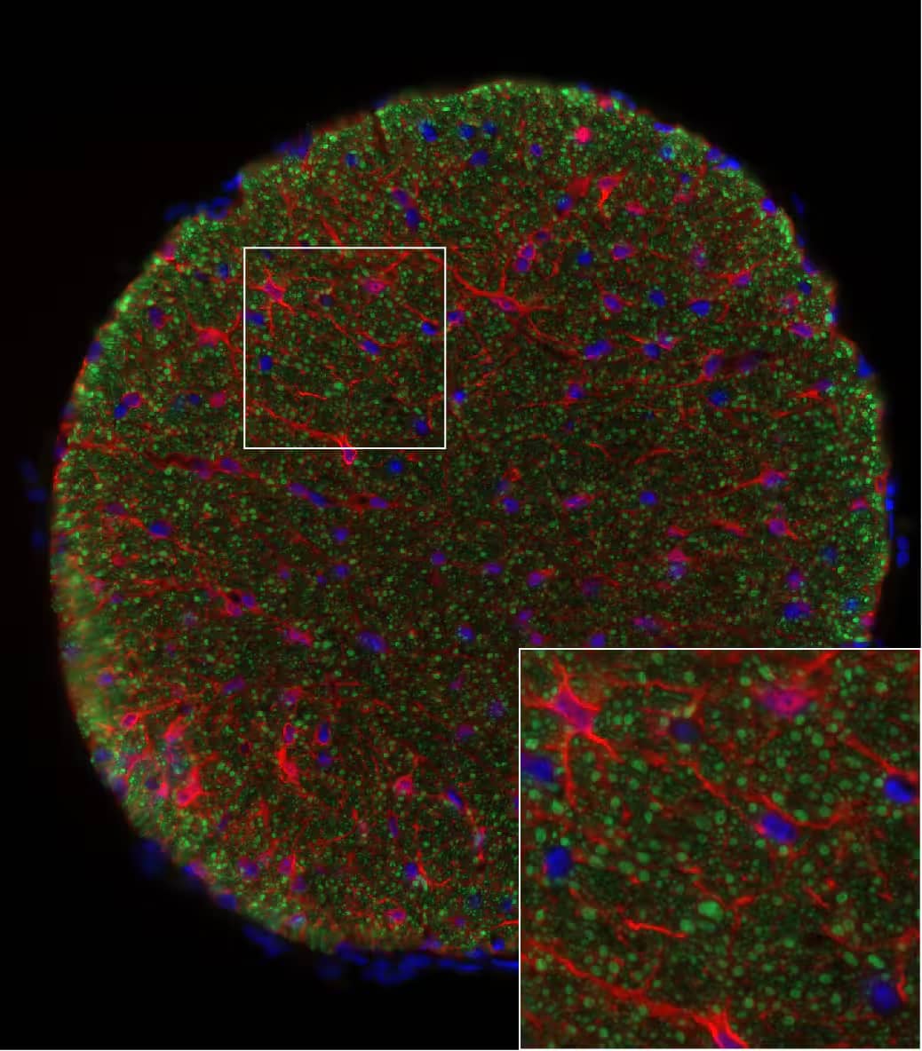 Immunohistochemistry-Frozen: Chicken Polyclonal NF-H Antibody [NB300-217] - Fixed frozen section of mouse optic nerve showing neurofilament heavy NB300-217 in green and S100B in red. NB300-217 was diluted 1 in 4000 and was left on tissue sections overnight at room temperature. Primary was detected with donkey anti chicken conjugated to Alexa 488. Image from a verified customer review.