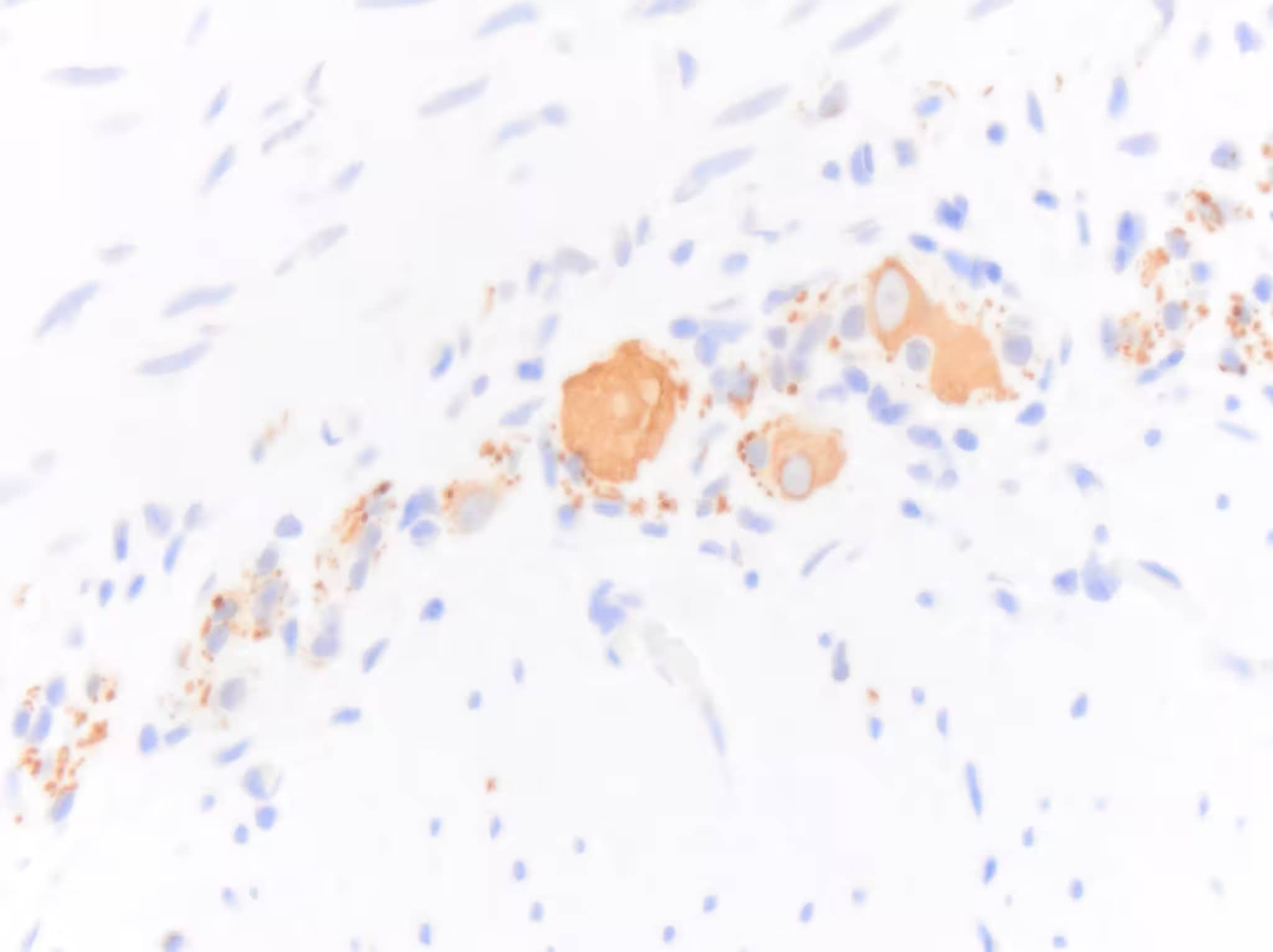 Immunohistochemistry-Paraffin: Chicken Polyclonal NF-H Antibody [NB300-217] - FFPE section of equine jejunum showing NF-H NB300-217 immunoreactivity in enteric neurons. Primary antibody was diluted 1 in 2000 and left on tissue sections for 30m at room temperature. Secondary was donkey anti chicken HRP. Image from a verified customer review.