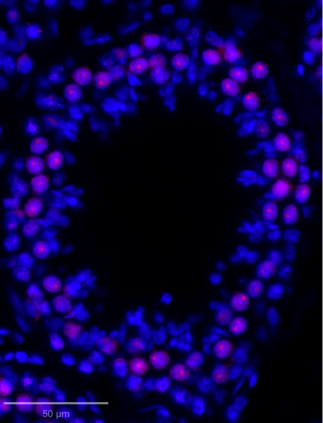 SYCP3 expression in adult male rhesus macaque testis seminiferous tubule. primary antibody - SYCP3 1:100.secondary antibody - donkey anti-rabbit 555.antigen retrieval buffer: 0.01M citrate (pH 6). Image from a verified customer review.