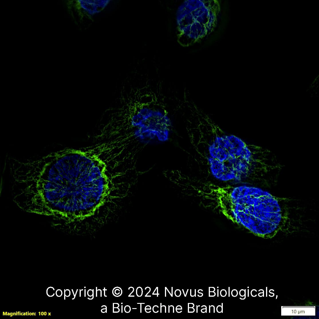 Nestin (10C2) was detected in immersion fixed SJCRH30 human Rhabdomyosarcoma cell line with Mouse anti-Nestin (10C2) Protein-G purified Monoclonal Antibody conjugated to Alexa Fluor® 488 (Catalog # NB300-266AF488) (green) at 5 µg/mL overnight at 4C. Cells were counterstained with DAPI (dark blue). Cells were imaged using a 100X objective and digitally deconvolved.