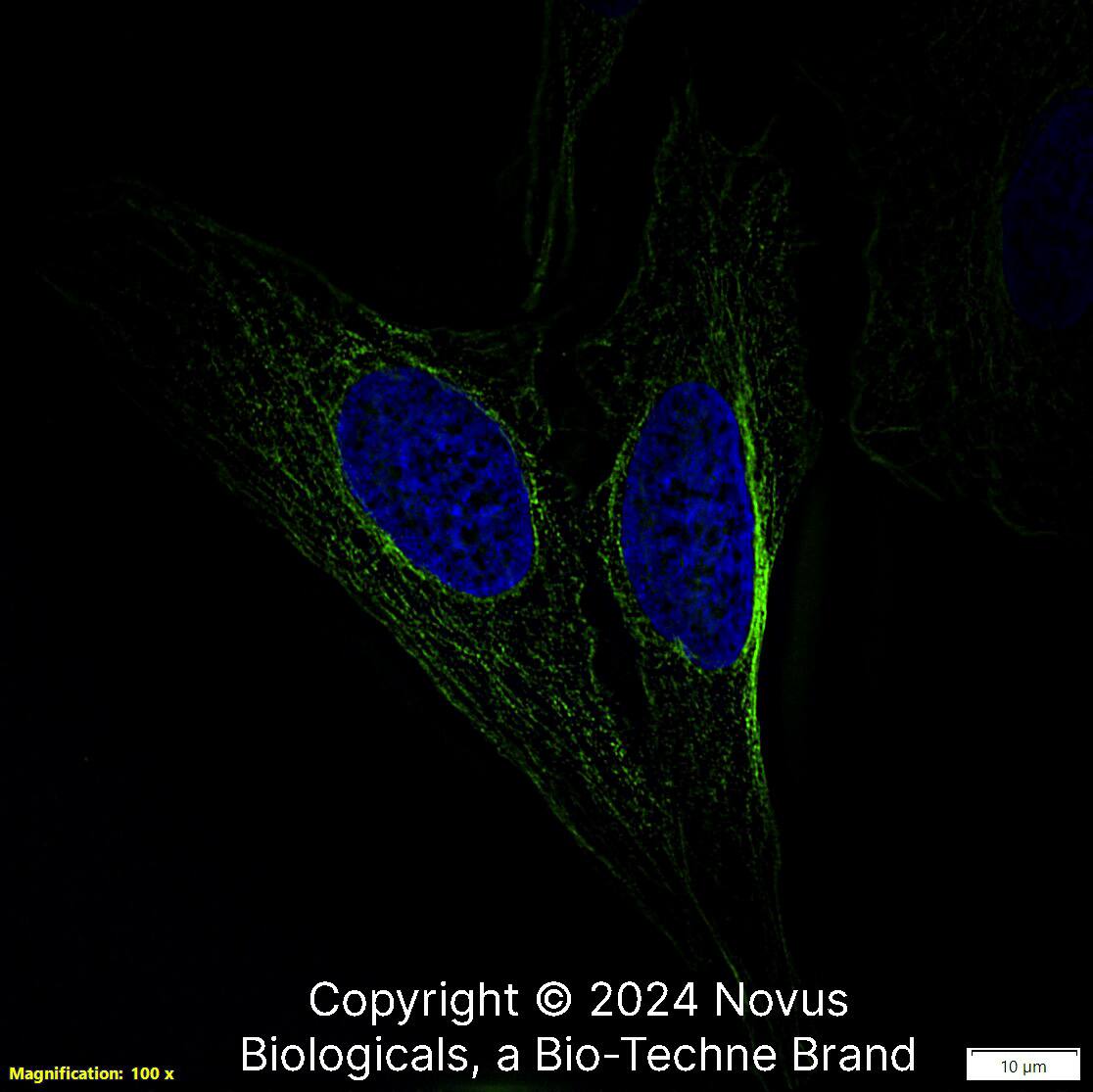 Alpha Tubulin (YL1/2) was detected in immersion fixed U-2 OS human osteosarcoma cell line using Rat anti-Alpha Tubulin (YL1/2) Protein G Purified Monoclonal Antibody conjugated to DyLight 488 (Catalog # NB600-506G) (green) at 5 µg/mL overnight at 4C. Cells were counterstained with DAPI (dark blue). Cells were imaged using a 100X objective and digitally deconvolved.