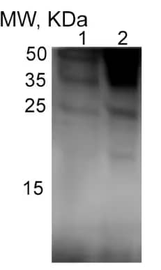 Western Blot: Rabbit Polyclonal IL-1 beta/IL-1F2 Antibody [NB600-633] - IL-1 beta/IL-1F2 Western blot of liver homogenate from control (1) and alcohol-fed mice (2). Image from a verified customer review.