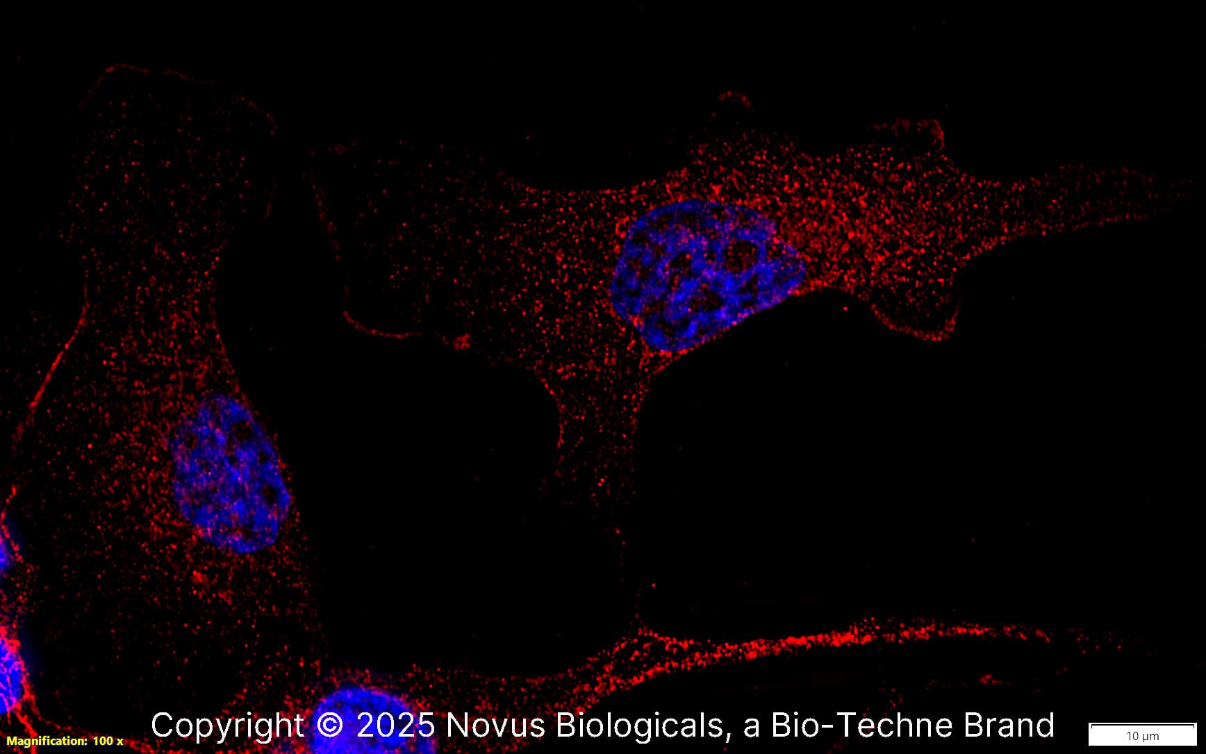 SR-AI/MSR was detected in immersion fixed SJCRH30 human Rhabdomyosarcoma cell line using Rabbit anti-SR-AI/MSR Antigen Affinity Purified Polyclonal Antibody conjugated to Biotin (Catalog # NBP1-00092B) at 5 µg/mL overnight at 4C. Cells were stained using Streptavidin conjugated to DyLight 550 (red) and counterstained with DAPI (blue). Cells were imaged using a 100X objective and digitally deconvolved.  
